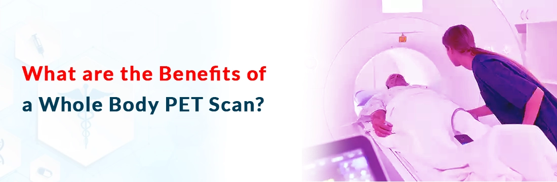  What are the Benefits of a Whole Body PET Scan?